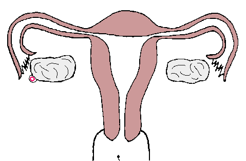 宫外孕的病因有哪些?(图1)